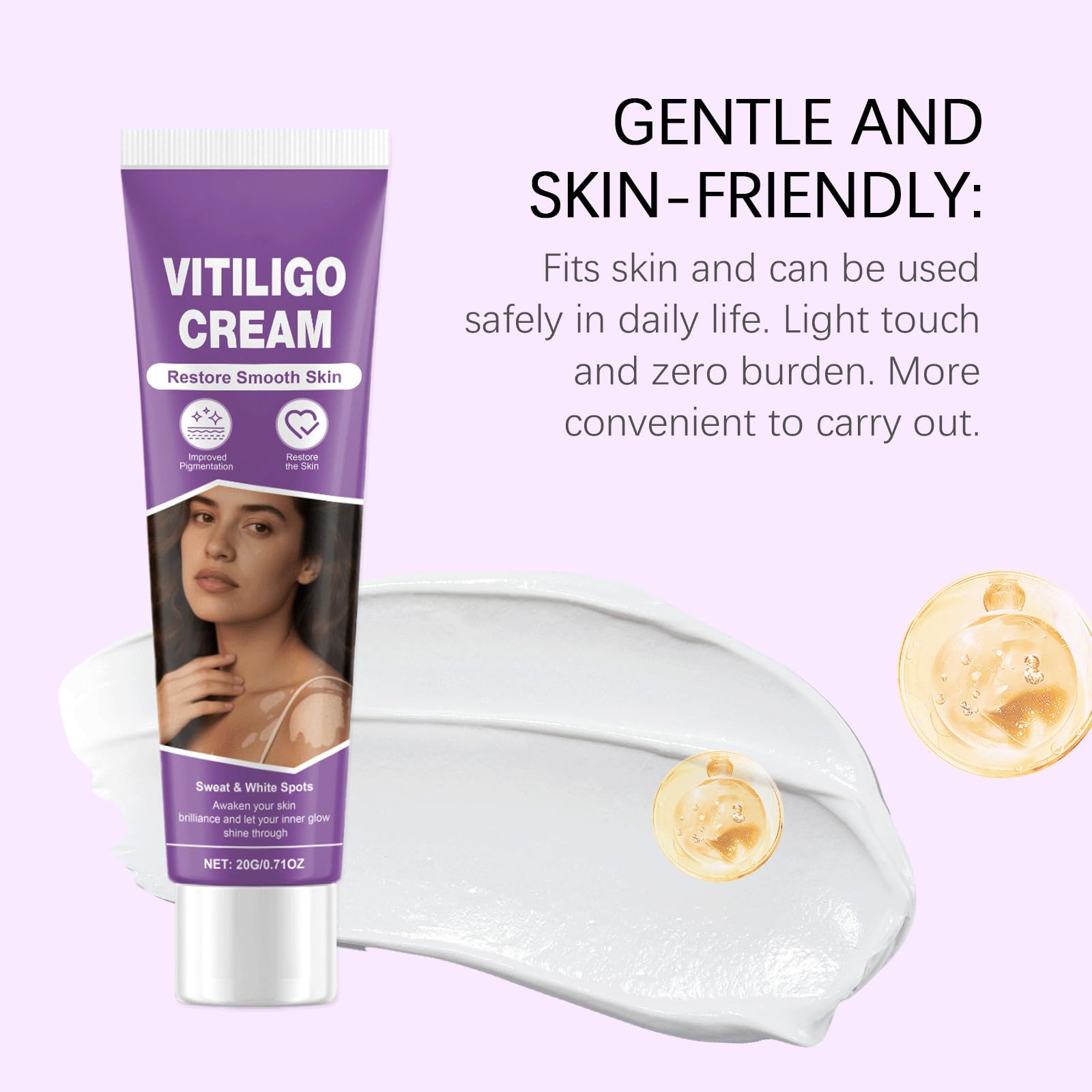 Applying Vitiligo Cream on arm demonstrates gentle, non-irritating care.