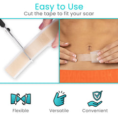 Vive Care silicone scar sheet roll application showing flexible fit on skin