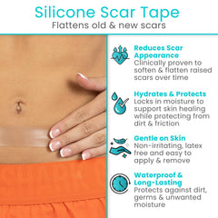 Vive Care silicone scar sheet roll cut-to-fit demonstrates customized scar management