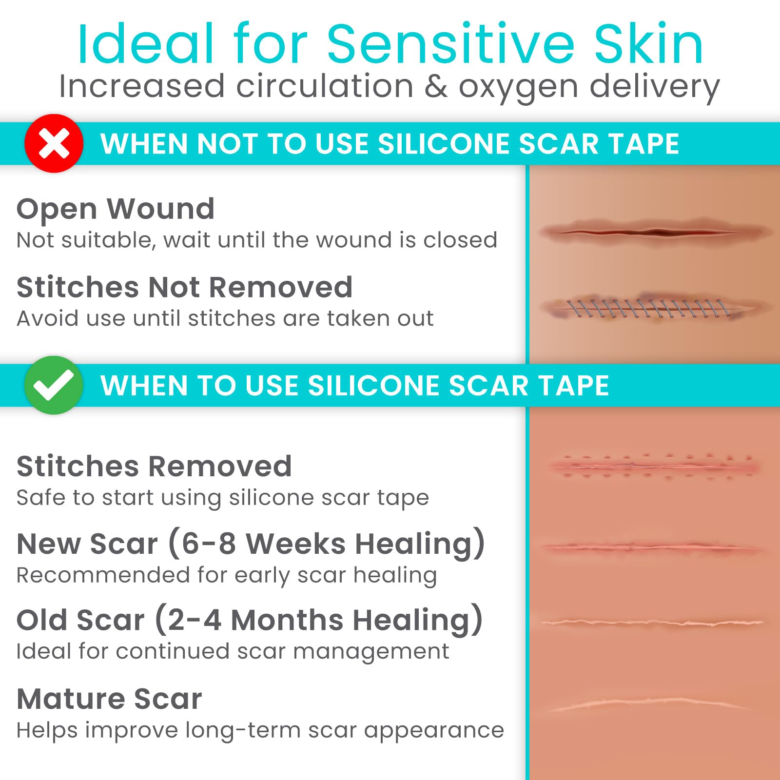 Vive Care silicone scar sheet roll flexible fit for various scar shapes