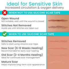 Vive Care silicone scar sheet roll flexible fit for various scar shapes