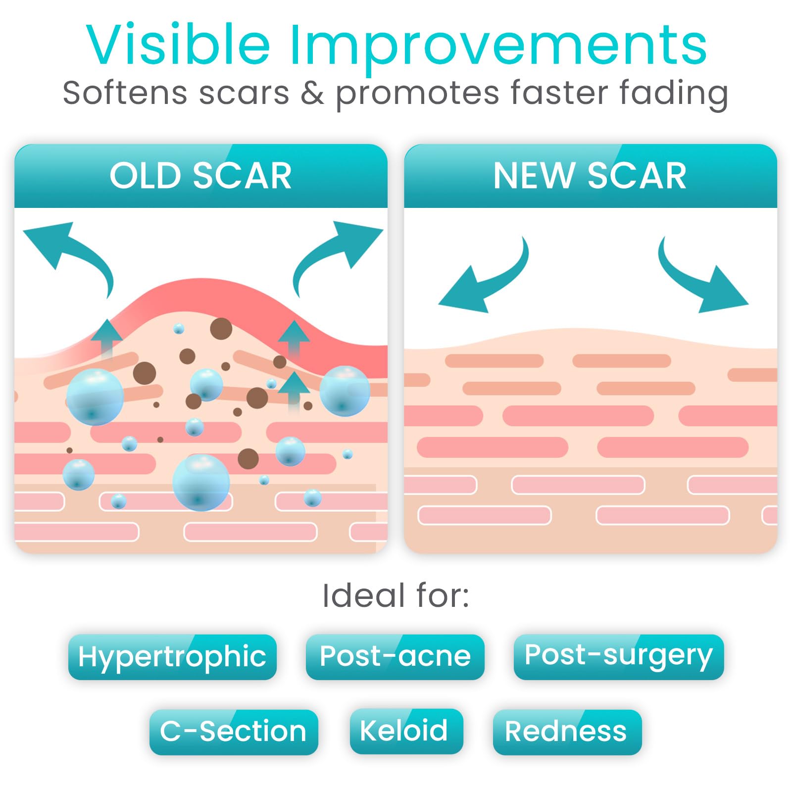 Vive Care silicone scar sheet roll waterproof protection for scar care during showers