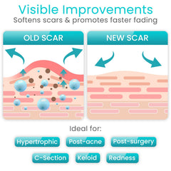 Vive Care silicone scar sheet roll waterproof protection for scar care during showers