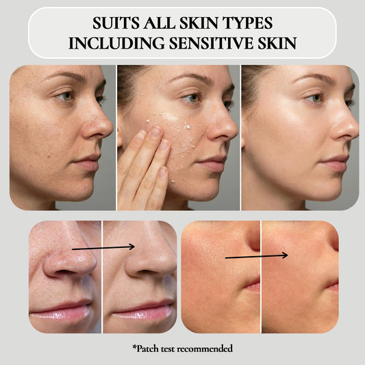 Vivo Per Lei gel texture clumps demonstrating non-abrasive lifting of dead skin.