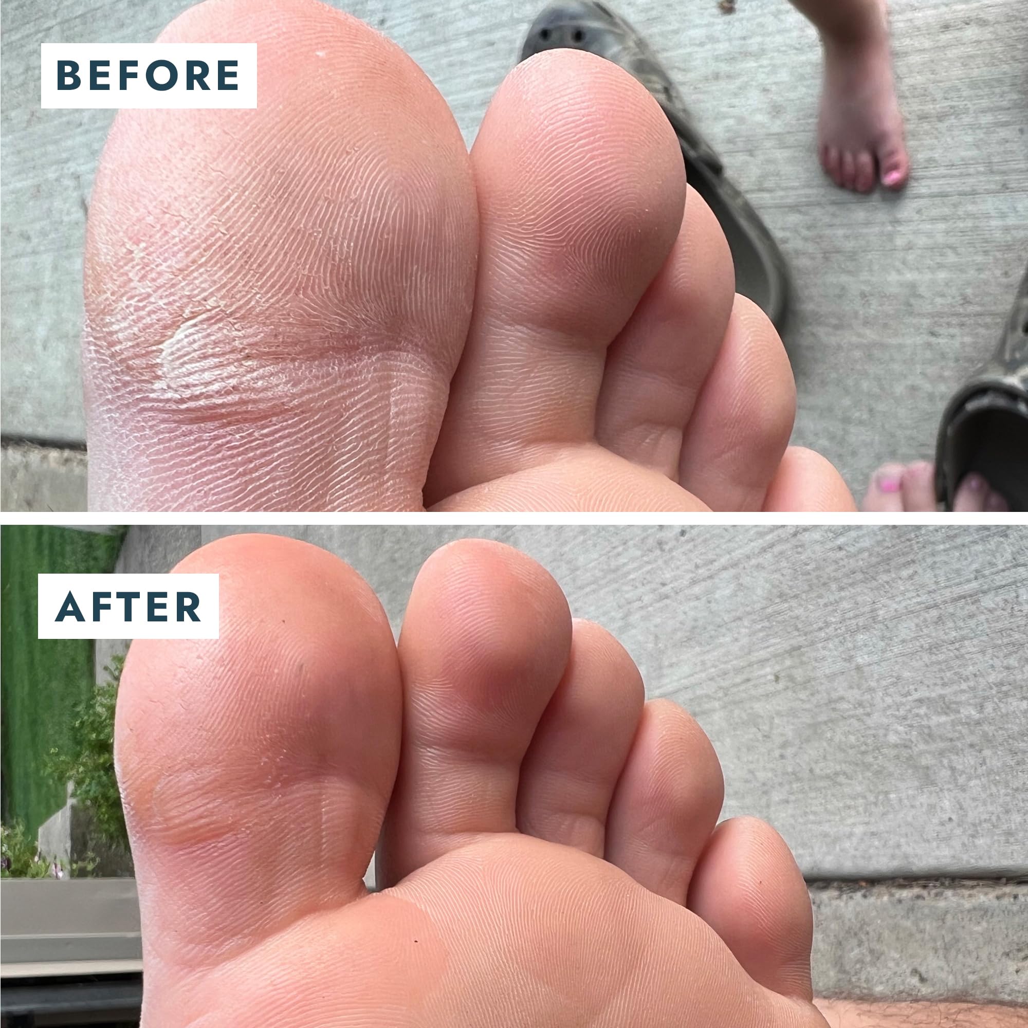 VOESH Solemate organic-olive-oil delivers rich hydration to heels.
