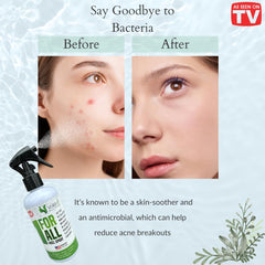 VoilaVe HOCl spray on skin after minor scrapes and bruises.