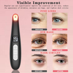 Vowleike Eye Lift Wand three-in-one modes target puffiness and circulation
