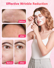 Vryioh smile line patches target laugh lines for refreshed appearance.