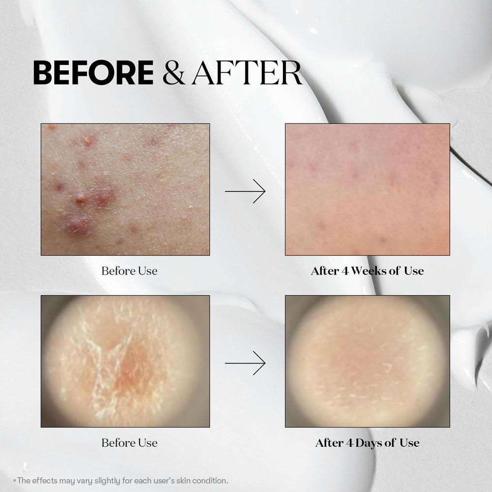 VT COSMETICS Reedle Shot 300 bottle emphasizes deeper delivery for enhanced skin vitality.