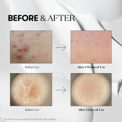 VT COSMETICS Reedle Shot 300 bottle emphasizes deeper delivery for enhanced skin vitality.