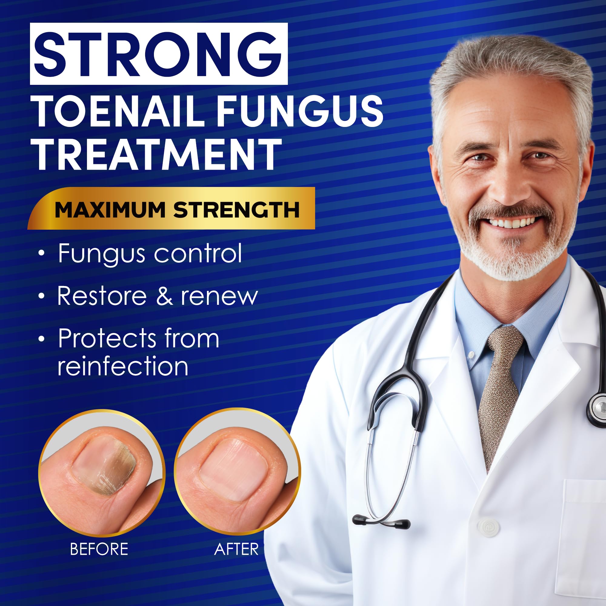 VTROUY applying solution on toenail demonstrates quick absorption for healthier-looking nails.