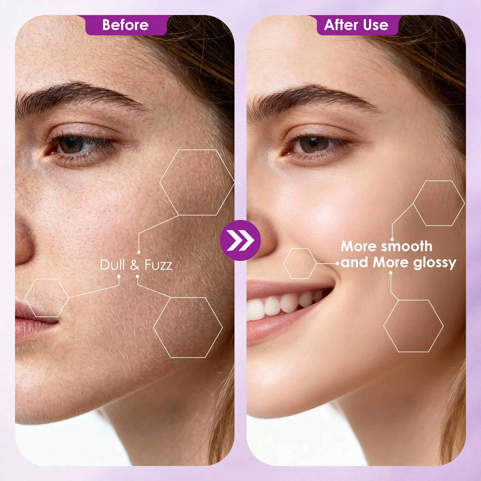 Vudex LED light illuminates skin for precise dermaplaning at home.