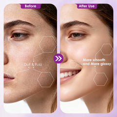 Vudex LED light illuminates skin for precise dermaplaning at home.