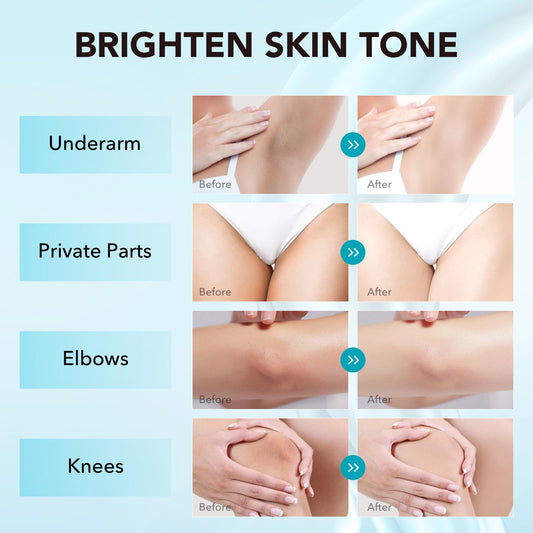 VZP Dark Spot Remover for elbows helping even skin tone with a light texture