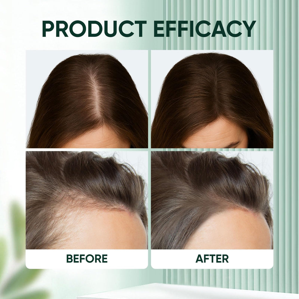 Application shot of WAESKI ampoule on thinning scalp areas.