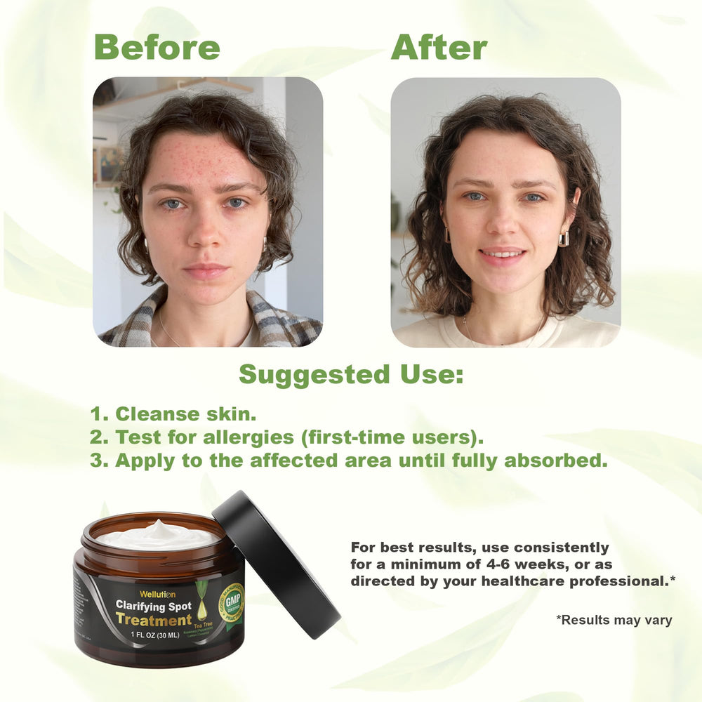 WELLUTION fast-acting 20-minute spot results for stubborn blemishes