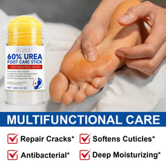 Weluno urea cream stick applied to heel to soften thick skin.
