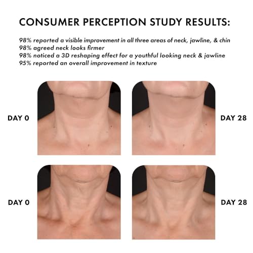 Whish Neck Cream 3D reshaping concept showing contour improvement.