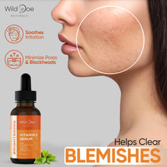 Wild Doe Naturals Vitamin C Serum USA-made label communicates clean ingredients.