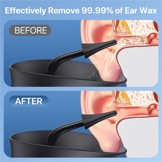 Wisdagaly ear cleaner temperature sensor indicates safe water temperature during use.