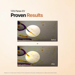 WISELY Ginseng Exosome First Essence applying on hand for quick absorption