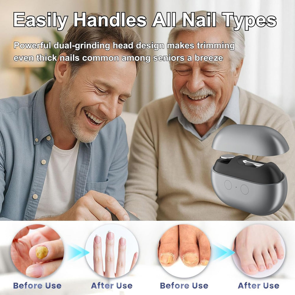 witpiny polishing function nails to smooth edges for a neat finish.