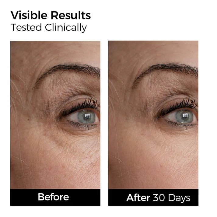 WNP 4D hyaluronic acid close-up emphasizes lasting moisture and supple texture.