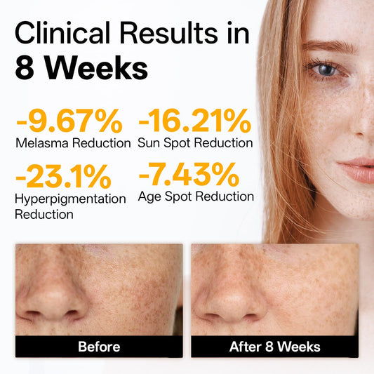 WNP Vitamin C Serum dropper dispensing a translucent bead formula for quick absorption.