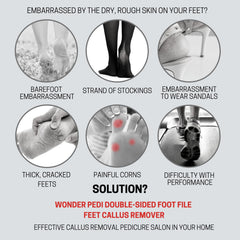 Wonder Pedi heel-care foot file ready to smooth dry, rough heels.