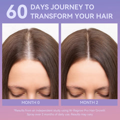 WXMX W-Regrow Pro non-greasy, fast-absorbing formula on the scalp
