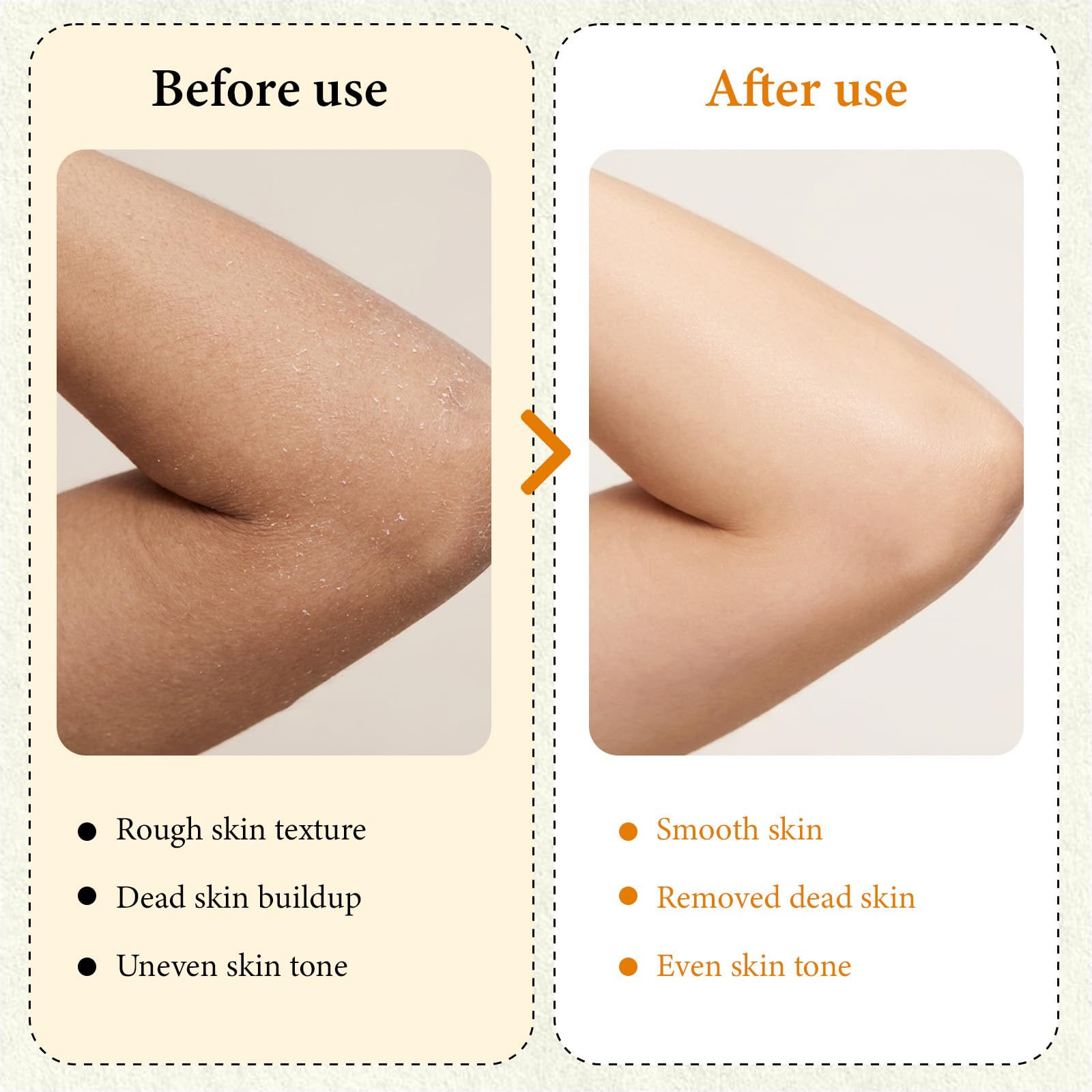 XILRVON Kojic Turmeric blend for brighter looking texture.