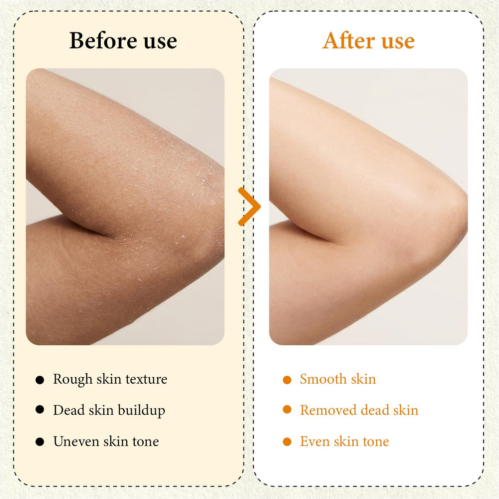 XILRVON Kojic Turmeric blend for brighter looking texture.