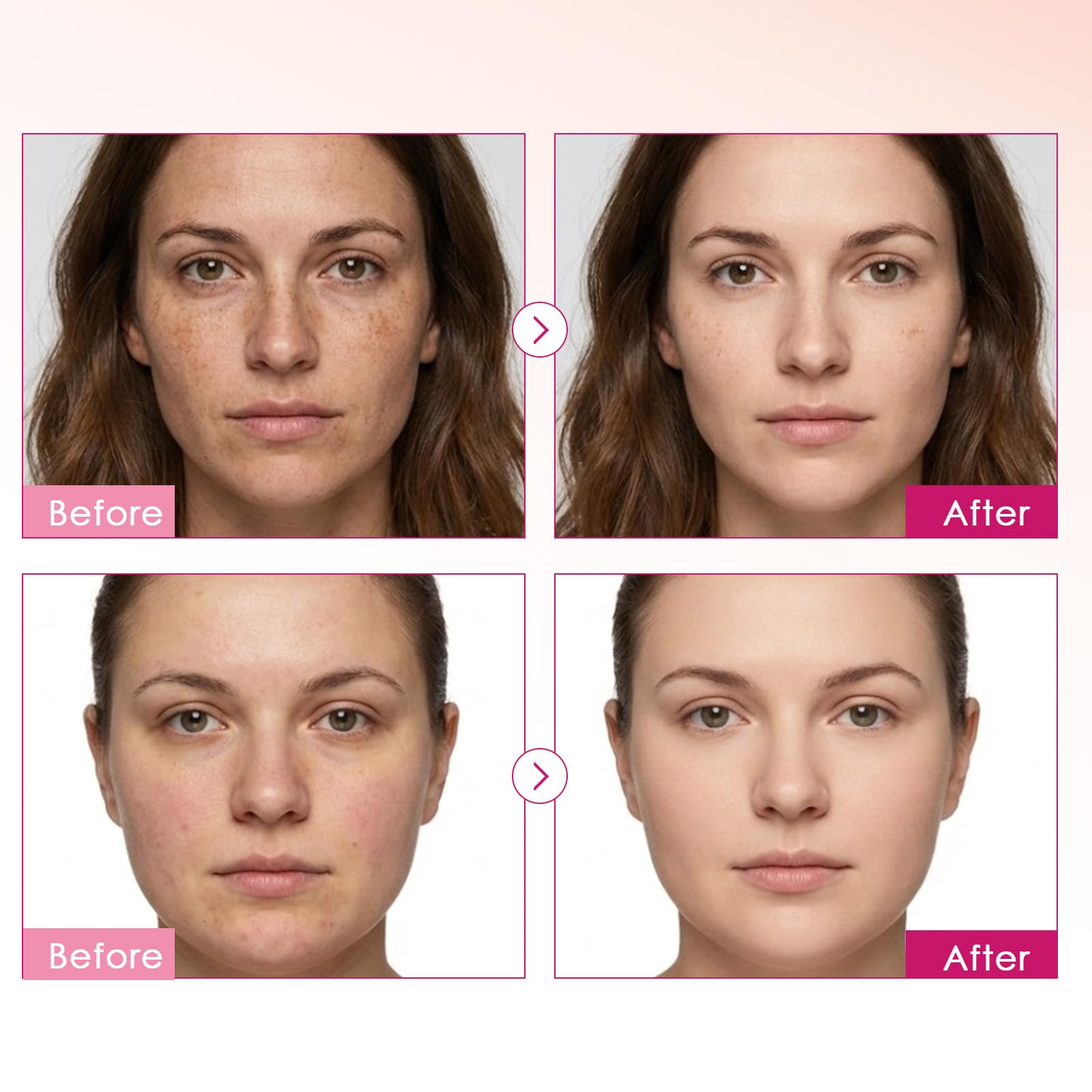 XILRVON niacinamide 1% label highlighting skin barrier support