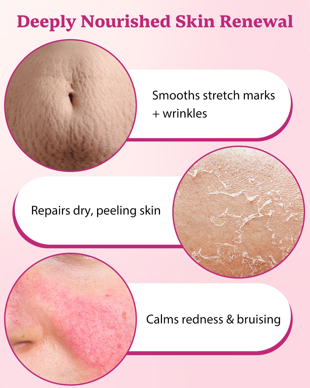 XUEBEIK Helichrysum balm ingredients with olive and jojoba oils delivering rich moisture