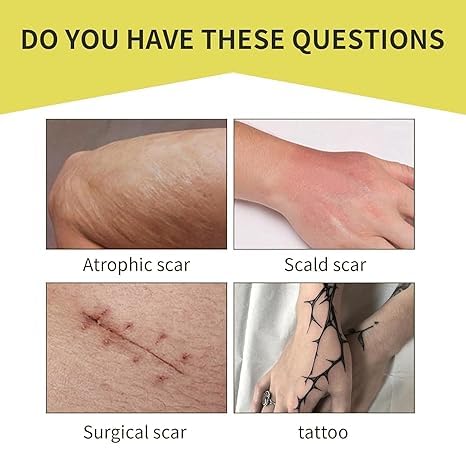 XUEVORIY patch works on tattoos, scars, birthmarks across body parts