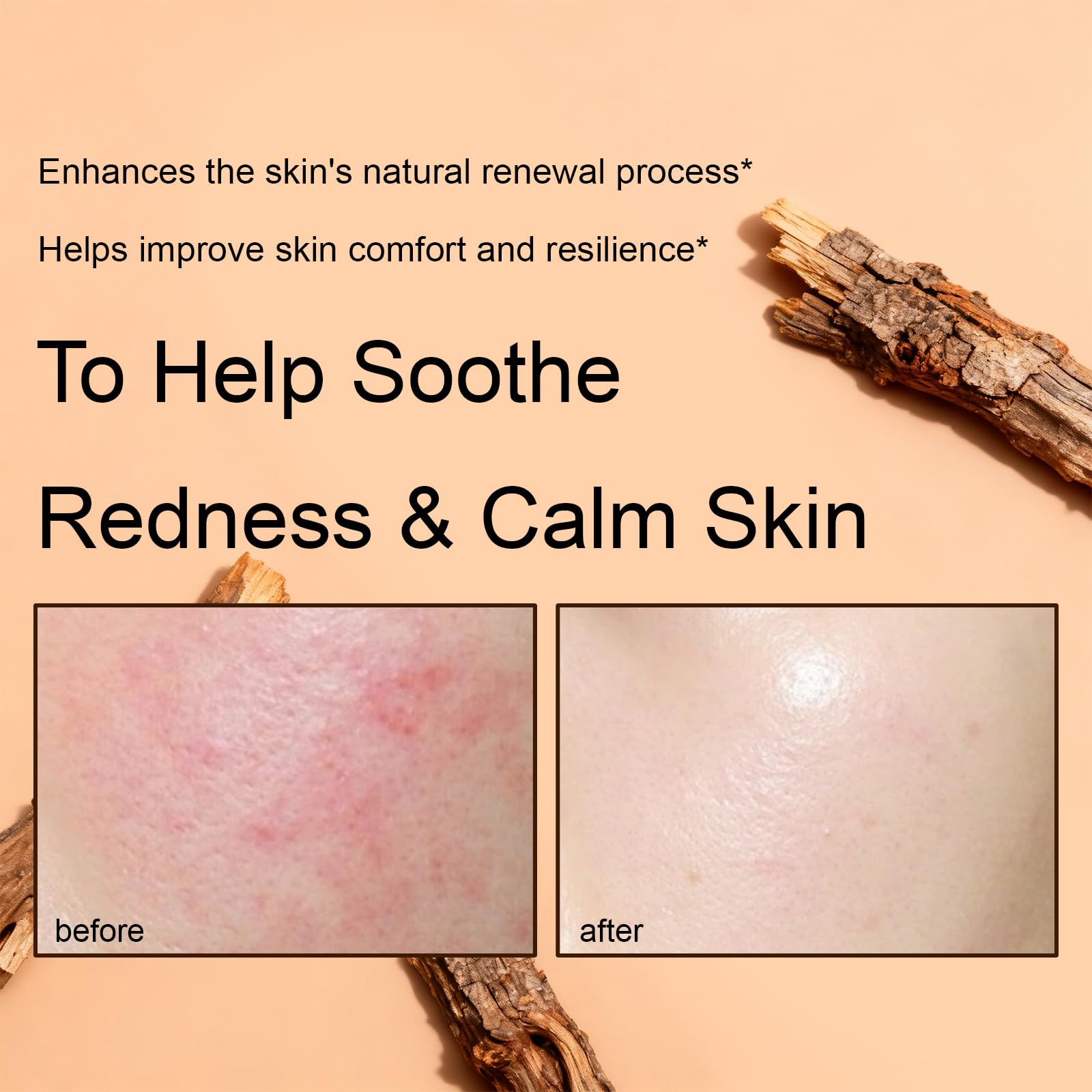 XUHUIT PDRN Rejuvenating Cream fragrance-free for sensitive skin.