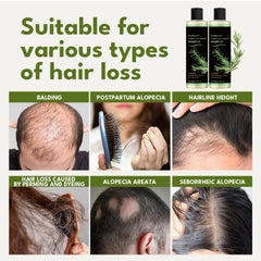 Scalp massage cue image from XYFSZDQJZHG shampoo demonstrating improved circulation