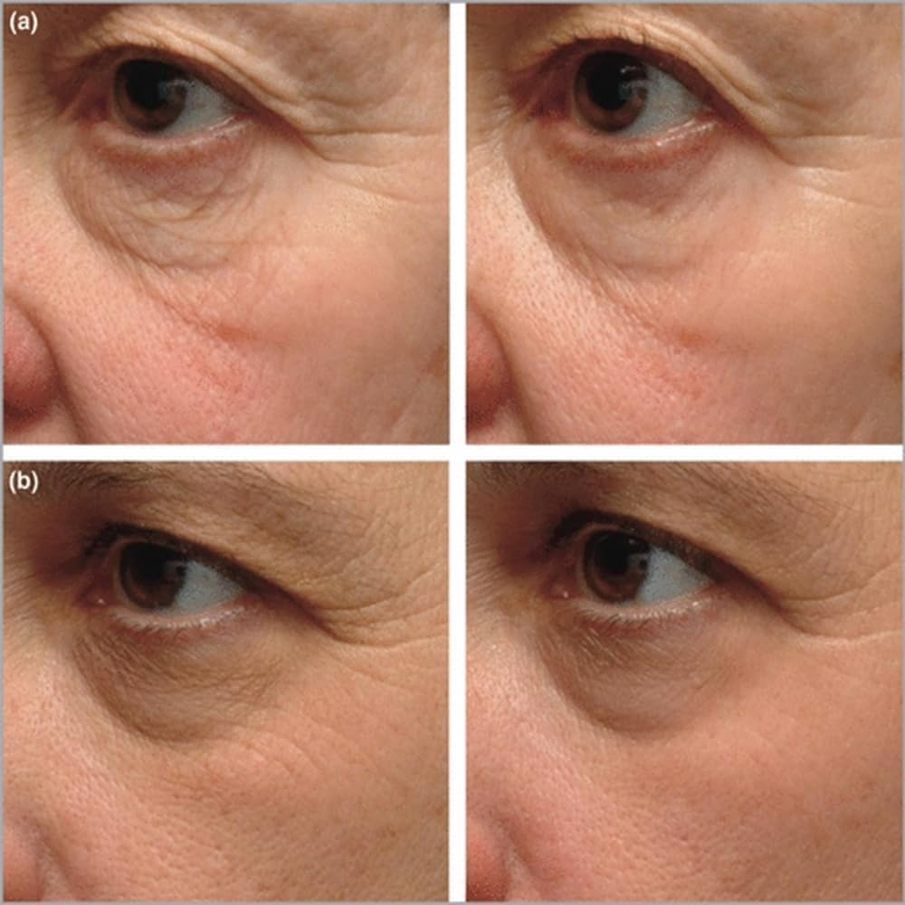 XYJIAXI Serum texture close-up reveals silky finish ideal for quick morning routines