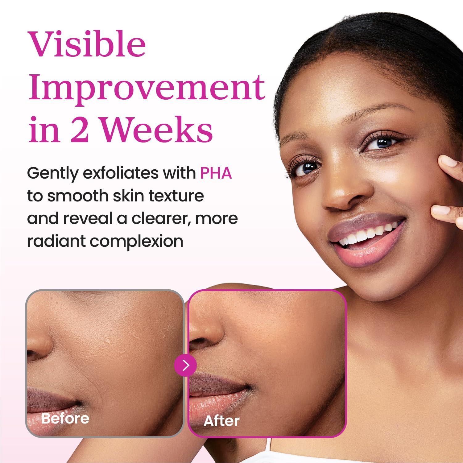 YADAH Collagen Hydra Essence contains niacinamide for gentle care