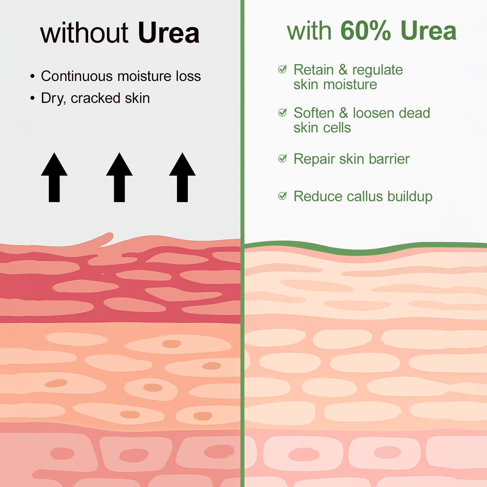 YAFUSIPE Foot care routine with Urea Cream for deep hydration.