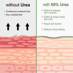 YAFUSIPE Foot care routine with Urea Cream for deep hydration.