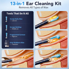 Yakbio ear cleaner 6 LED lights illuminate the ear canal for clear visibility.