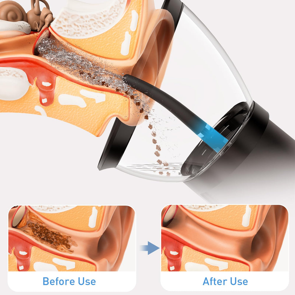 Yakbio ergonomic grip enables one handed operation for convenient use.