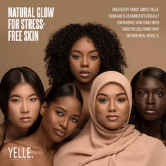 Yelle After cleansing glow shows refreshed skin ready for routine.