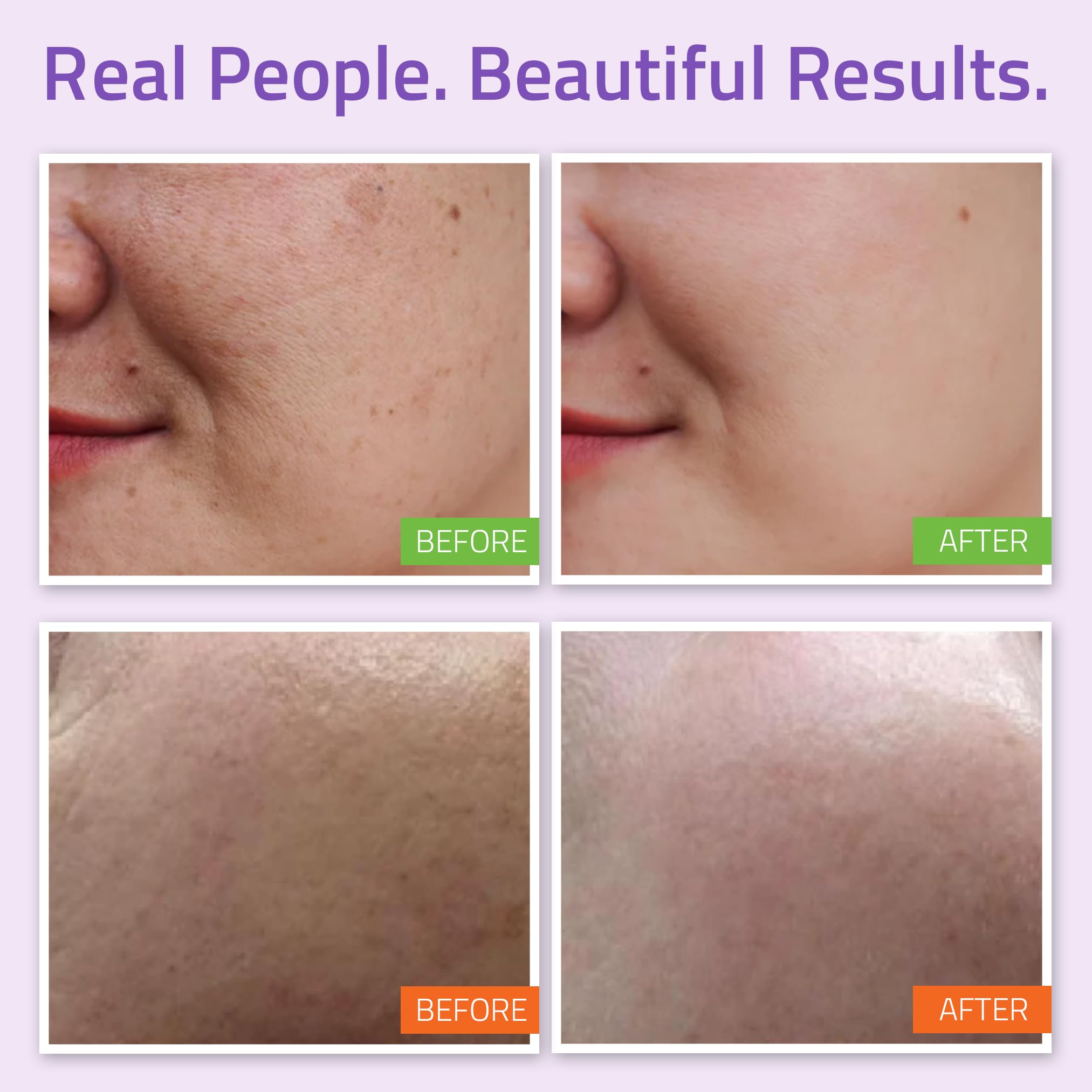 YEOUTH Vitamin C Serum bottle to target dull patches and boost radiance.