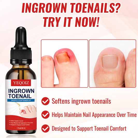 YEQOIZ ingrown toenail corrector with lever mechanics aligns nail growth.