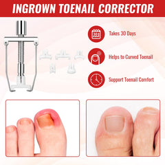 YEQOIZ toenail file lifter helps gentle lifting and shaping.