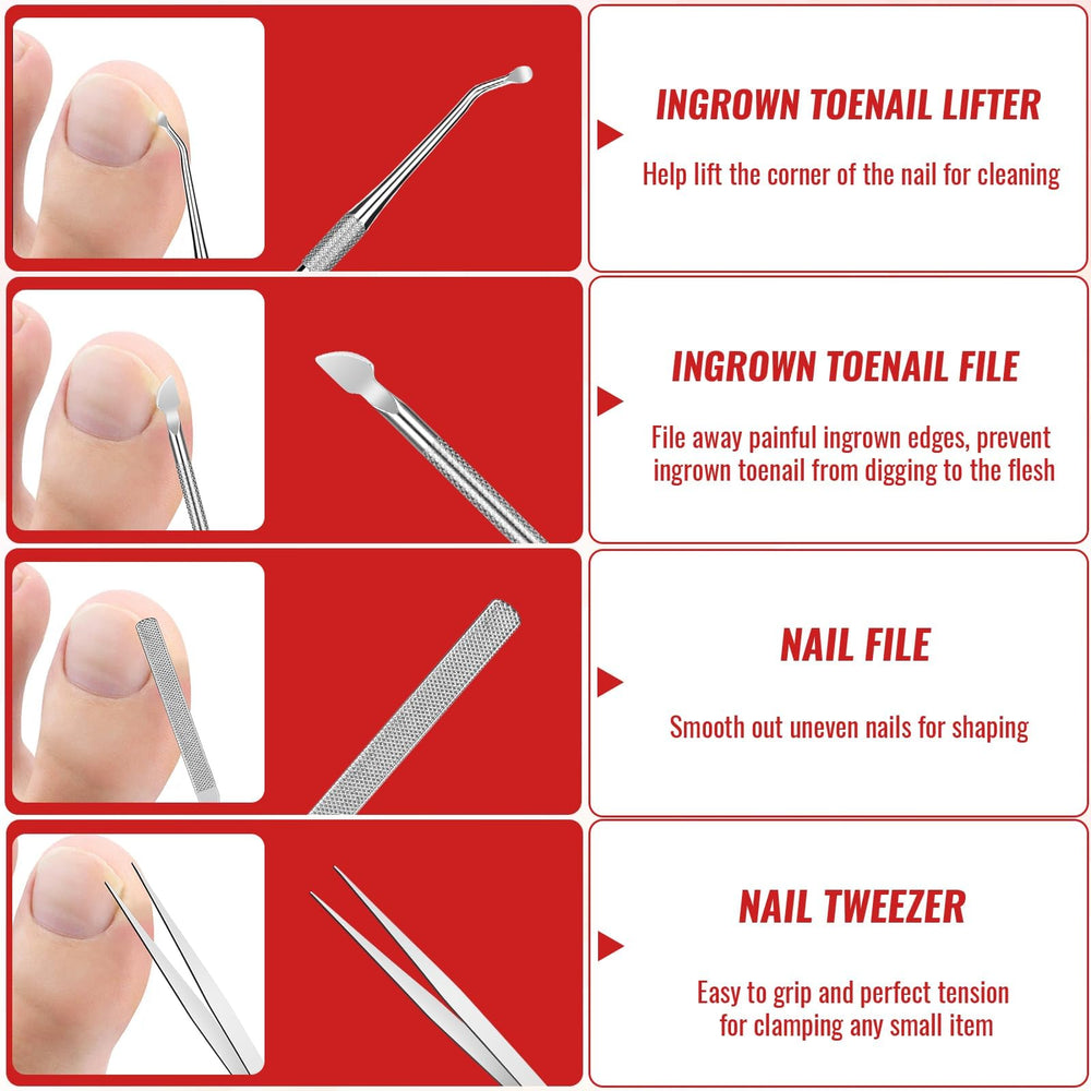 YEQOIZ toe protector guards protect nails during treatment.