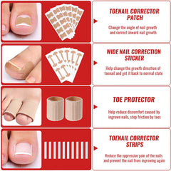 YEQOIZ wide nail correction stickers aid gradual alignment.