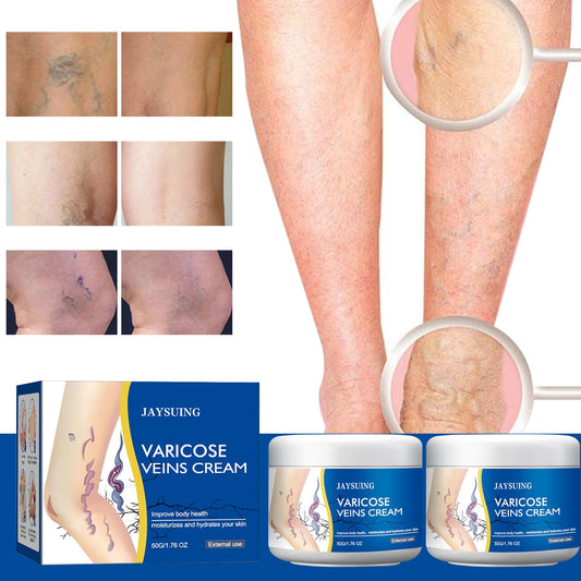 Yetary 2pcs pack varicose veins cream for legs showcased for everyday use.